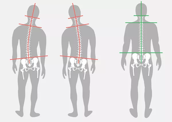 Hip-Balance Hip-Balance